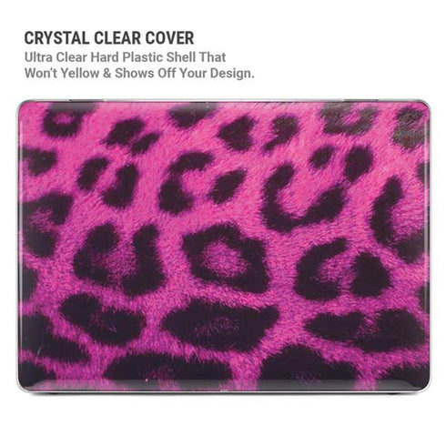 Pink Leopard Spots MacBook Pro 14in (2021-24) Case plus Skin